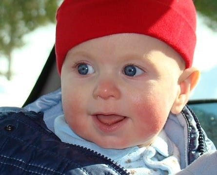 Atópiás dermatitis és megelőzés